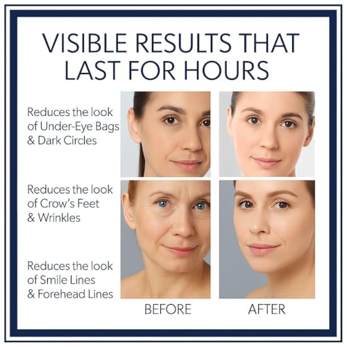 Instant Firming Eye Serum | 10ml,0.35 oz, Reduces Under-Eye Bags, Wrinkles, Dark Circles, Fine Lines & Crow's Feet – Anti-Aging Wrinkle Remover (Unscented)