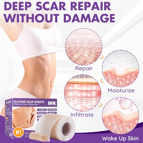 Silicone Scar Sheets Roll - 2M Reusable Soft Silicone Tape for Surgical & Keloid Scars