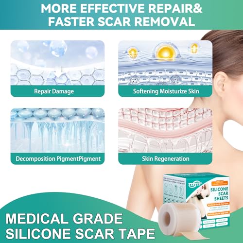 Reusable Silicone Scar Sheets for Face & Body - Medical Grade, 1.6x60 Inch Roll