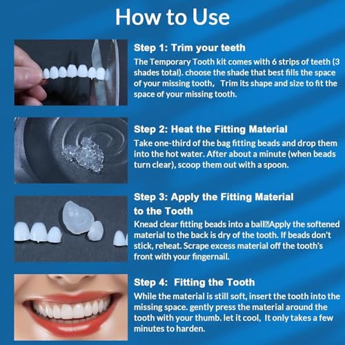 Veneers Teeth for Women, Tooth Replacement Missing Teeth, Upper Veneer Cosmetic Tooth, Moldable Thermal Beads Replacement Kit, Unisex to Denture Repair Kit, 6PCS