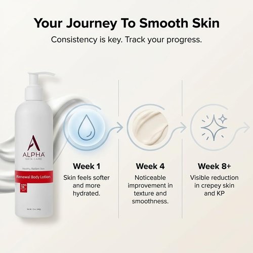 Alpha Skin Care Revitalizing Body Lotion, 12% Glycolic AHA, Simple & Effective Daily Moisturizer with Alpha Hydroxy Acid, Hydrates & Exfoliates for Soft, Smooth Skin, Anti-Aging, 12 Oz
