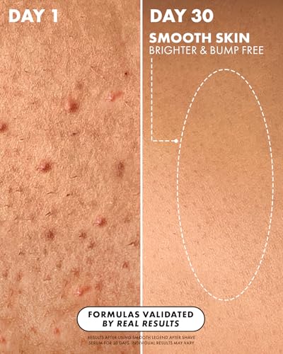 Post-Shave Serum for Bumps & KP Reduction - Smooth Skin & Hydration