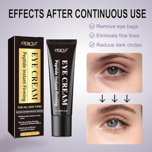 Temporary Instant Eye Tightener Cream – 30 ML Under Eye Cream for Men & Women, Helps Improve the Appearance of Dark Circles, Puffiness & Fine Lines, Anti-Aging & Firming, Mild Hydrating Formula,1PACK
