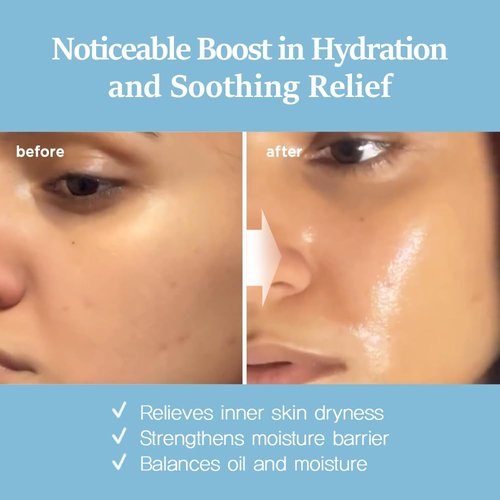 Nightingale Ecto-Hyaluronic Ampoule - 8-Layer Hyaluronic Acid Serum for Dry Skin | Fragrance-Free & Vegan