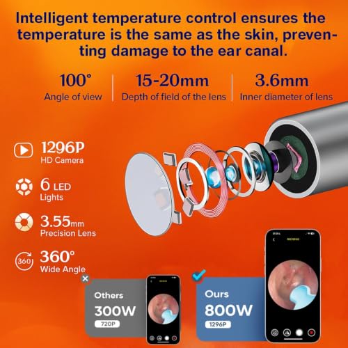 Ear Wax Removal Tool with Camera 1296P HD, Wireless Ear Scope Kit with 8 Tips - Cream Milky