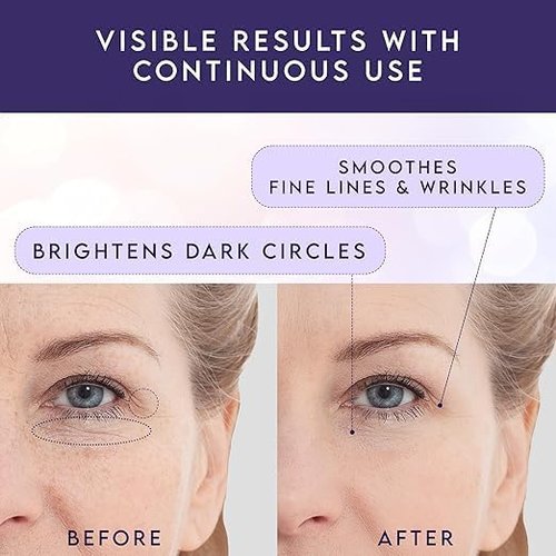 Retinol Eye Stick & Caffeine Under Eye Brightener – Under Eye Balm Stick for Dark Circles, Puffiness, Eye Bags, Wrinkles & Fine Lines, Cooling Under Eye Stick, 2 Pack