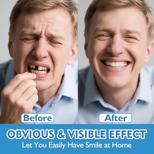 Moldable False Teeth - Veneers Teeth for Women & Men, Silicone Dentures Set for Both Upper and Lower, Temporary Dentures DIY at Home Within Minutes Fix Your Smile 1PCS