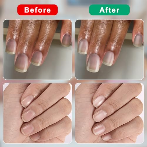 Nail Buffer and Shine Kit - 20 Pack with 1000/4000 Grit - Big Purple Variation