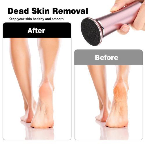 LIERKISS 120pcs Replacement Sandpaper Discs for Electric Foot File Professional Replaceable Sandpaper Refill Discs for Electric Callus Remover to Remove Callus Dead Cracked Skin Remover