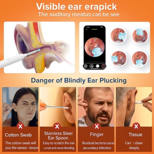 Ear Wax Removal Tool with Camera 1296P HD, Wireless Ear Scope Kit with 8 Tips - Cream Milky