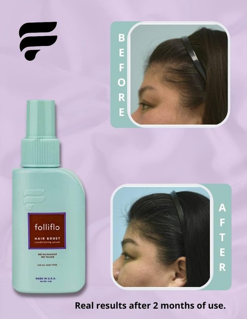Folliflo Hair Boost Leave-In Conditioner Spray | Lightweight Daily Serum for Thicker Hair - 90 Day Supply