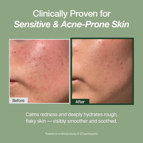 NATURAL DERMA PROJECT NDP Green Caper Milky Toner Essence - Hydrating Korean Toner for Face, Deep Moisture for Sensitive and Dry Skin, Panthenol, Madecassoside (4.39 Fl oz / 130ml)