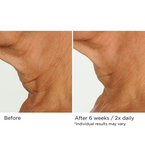 NassifMD Neck & Decollete Firming Complex - Lifting Formula for Youthful Skin
