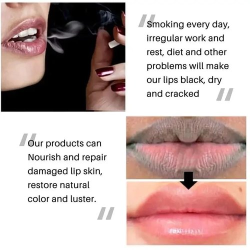 Skiennix Collagen Lip Booster Serum - Plumping & Anti-Wrinkle Treatment for Youthful Lips