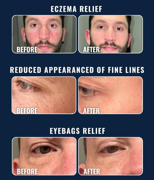 Prettyboy Face Revival Gel Moisturizer for Men - Hydrating Cream for Dry Skin & Redness Relief - Anti-Aging & Fragrance-Free - 1 Count