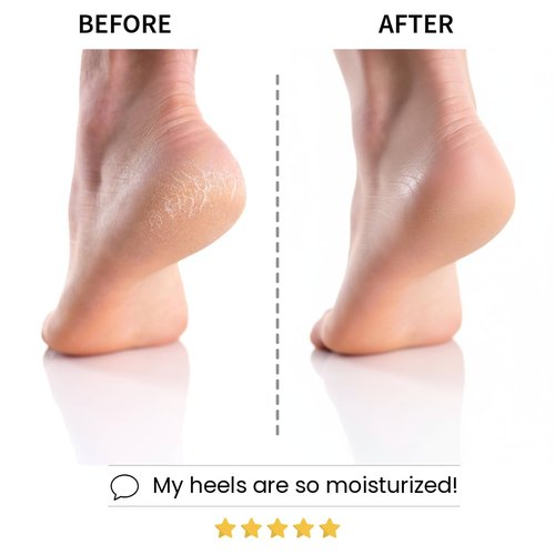 Codi New York Relaxing Aroma Foot Mask, Home Spa Moisturizing Pedicure Socks, 6 Pairs, For Dry Cracked Heel, Hydrating Foot Treatment, Made in Korea (Peppermint)