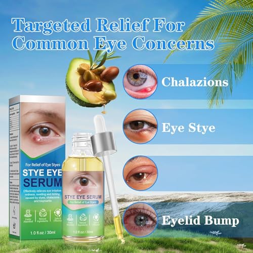 Stye Eye Relief Serum Natural Eyelid Drops for Styes Blepharitis & Chalazion Fast-Acting Relieve Eye Irritation Redness & Swelling Gentle Formula 1.01 Fl oz/30 Ml