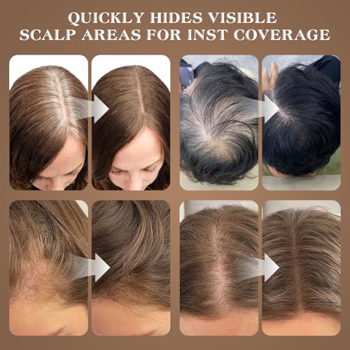 Hairline Shadow Powder - Middle Brown Root Touch Up for Gray Cover & Thinning Hair