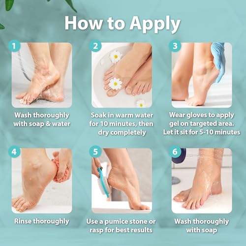 Ebanel Salon-Grade Callus Remover Gel with 20% Urea, 8.5 oz Pedicure Peel - Pack of 1
