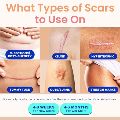 Silicone Scar Tape for Surgical & Keloid Scars, Reusable 1.6x60 Inch Roll