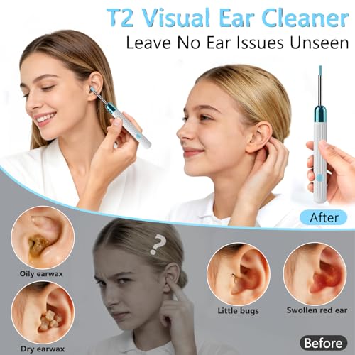 Ear Wax Removal Camera Tool with 1080P HD & 6 LED Lights - White