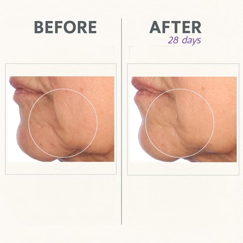 Serious Skincare Reverse Cream In-Tense - Firming Facial Moisturizer for Lifted Face & Neck | 1.7 oz Anti-Aging Solution