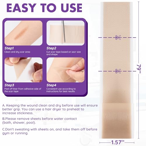 Silicone Scar Sheets Roll - 2M Reusable Soft Silicone Tape for Surgical & Keloid Scars