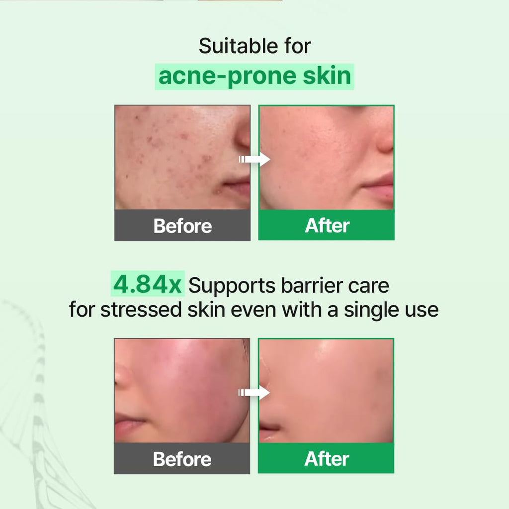 Zipiderm EGF Skin Barrier Cream Toner – Korean Milky Hydrating Toner for Dry, Sensitive & Acne-Prone Skin with Ceramides, Hyaluronic Acid, Rice Bran & Soy Protein, Moisturizing Skincare, 5.07 fl oz