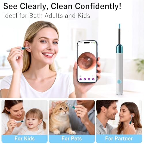 Ear Wax Removal Camera Tool with 1080P HD & 6 LED Lights - White