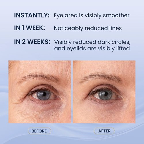 SKIN ULTIMA Dual Eye Cream - Advanced Retinol & Peptides for Dark Circles & Puffiness | 0.68 OZ