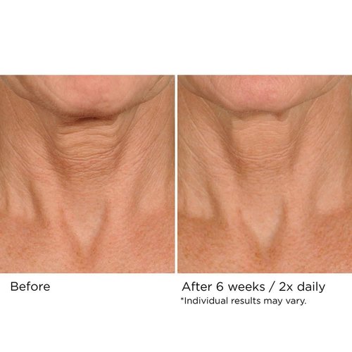 NassifMD Neck & Decollete Firming Complex - Lifting Formula for Youthful Skin