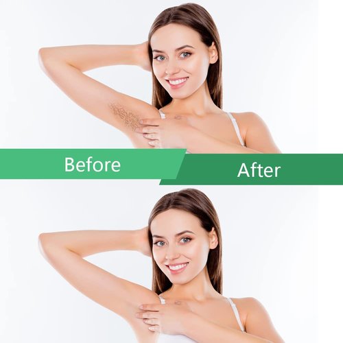Bestidy Hard Wax Beads for Hair Removal - 1000g Waxing Beans for All Body and Bikini Areas (Green)