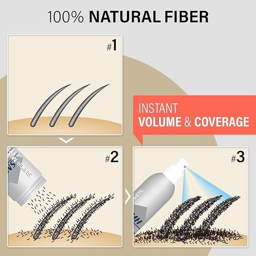 Super Million Hair SMH Hair Fibers MADE IN JAPAN – Instantly Conceals Thinning Hair –Long-Lasting – Sweat, Water & Wind Resistant – Hair Loss Solutions For Men & Women (Medium Brown, 15g)
