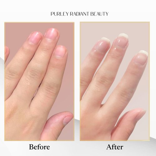 Purely Radiant Beauty Nail Growth Oil – Natural Cuticle Serum for Stronger Nails & Healthy Growth | Jojoba, Castor, Coconut & Argan Oils | Prevents Breakage, Peeling & Brittleness (3ml)
