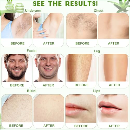Coarse Hard Wax for Hair Removal - 1.5lbs Brazilian Waxing with Tea Tree, Suitable for Body & Face, Variation: Tea Tree / 24 Ounce