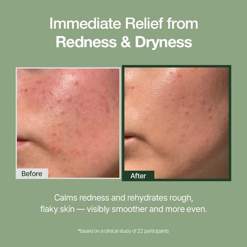 Natural Derma Project Deep Hydration Cream - Calming & Soothing Moisturizer for Sensitive Skin | 80ml