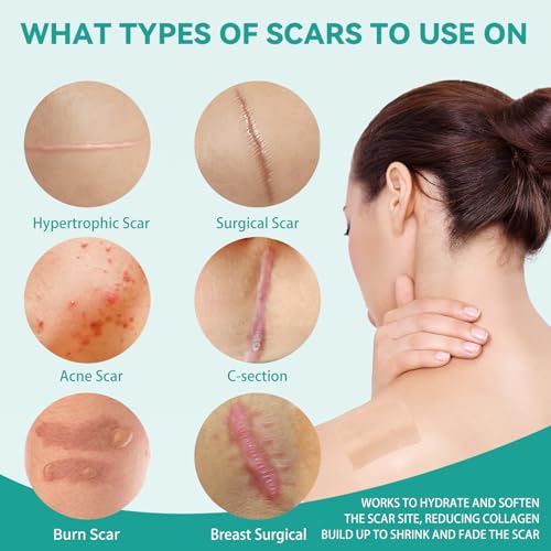 Reusable Silicone Scar Sheets for Face & Body - Medical Grade, 1.6x60 Inch Roll