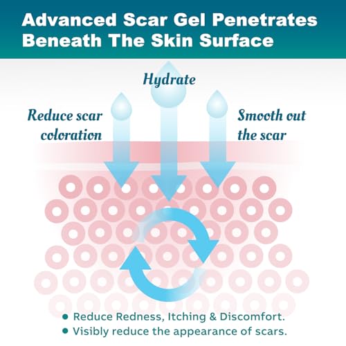 Advanced Scar Gel for Surgical, Burn & Injury Scars - 50g