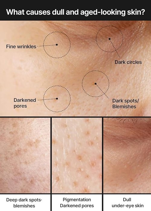 Celimax Pore+Dark Spot Brightening Cream - Niacinamide & Tranexamic Acid | Hydrating for Sensitive Skin, 35ml