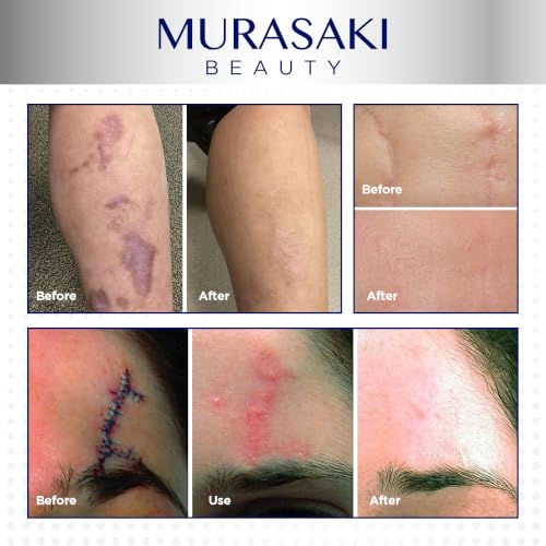 Silicone Scar Gel for Surgical and Keloid Scars - 2.12 oz, Max Strength, Invisible, Fast-Drying