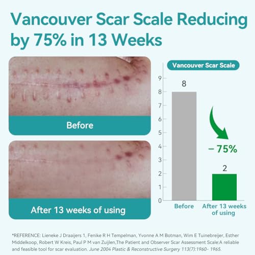 Silicone Scar Sheets - Ultra Soft Hypoallergenic Scar Tape 1.6”x60