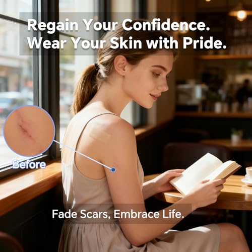 Reusable Silicone Scar Tape 1.5M - Skin Healing & Scar Minimize