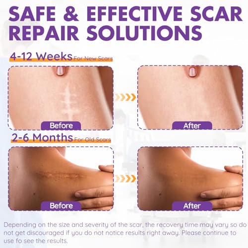 Silicone Scar Sheets Roll - 2M Reusable Soft Silicone Tape for Surgical & Keloid Scars