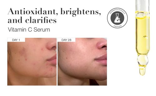 Infinitek Paris | Vitamin C Face Serum - Hydrating & Brightening Antioxidant with Green Tea & Ginseng | 1 fl oz / 30 ml