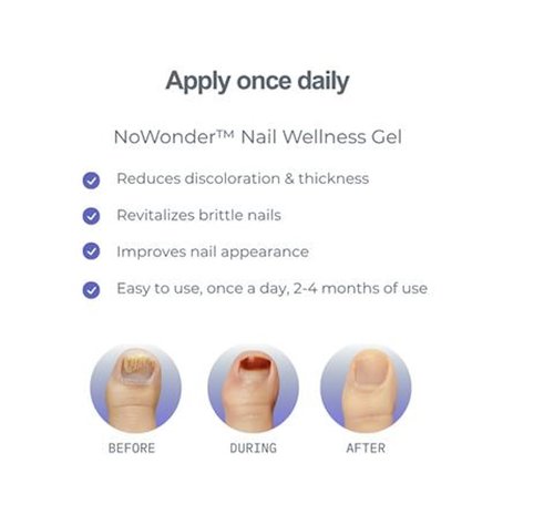 NoWonder Nail Wellness Gel - Nitric Oxide Nail Renewal Solution for Healthier, Clearer Nails | Easy-to-Use, Non-Prescription Care