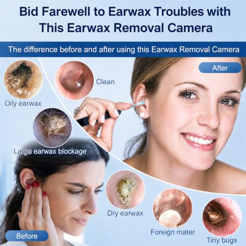 Ear Wax Removal Camera with 1080P HD, Waterproof IP67, WiFi App - Black
