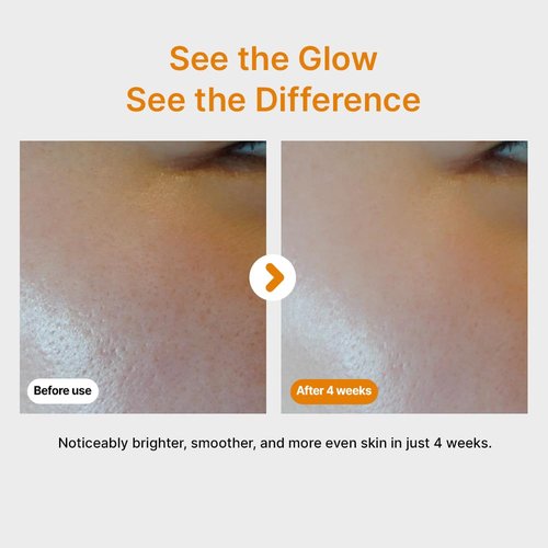Pure Vitamin C Serum - Brightening & Firming Korean Skincare | 10.5% Vitamin C, 30ml/1.01fl.oz