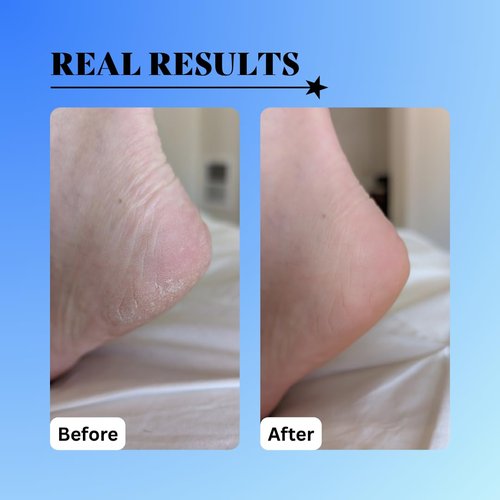 10% Glycolic Treatment Tonic Exfoliating Toner for Face and Body, Alcohol Free, Combats Acne and Hyperpigmentation, Rough Skin, All Skin Types Including Sensitive
