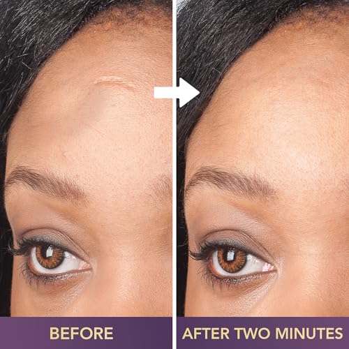 Dermaflage 4-Pack Scar Filler Applicator Bronze Dark for Scar Removal