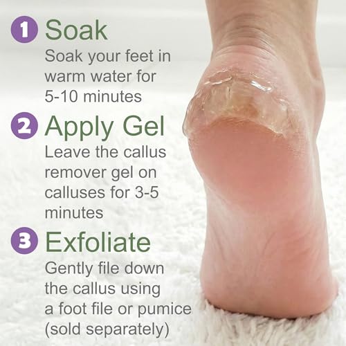 16 oz Extra Strength Callus Remover Gel for Feet - Professional Foot Care